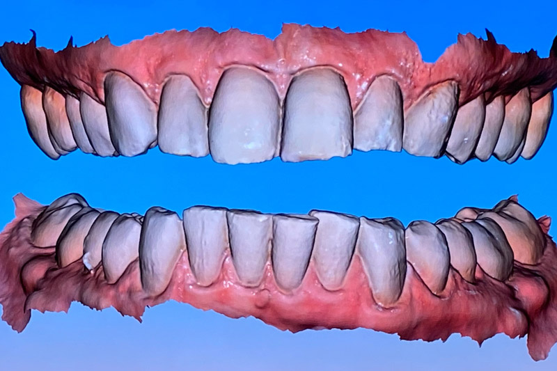 Dental Patient oral scan complete